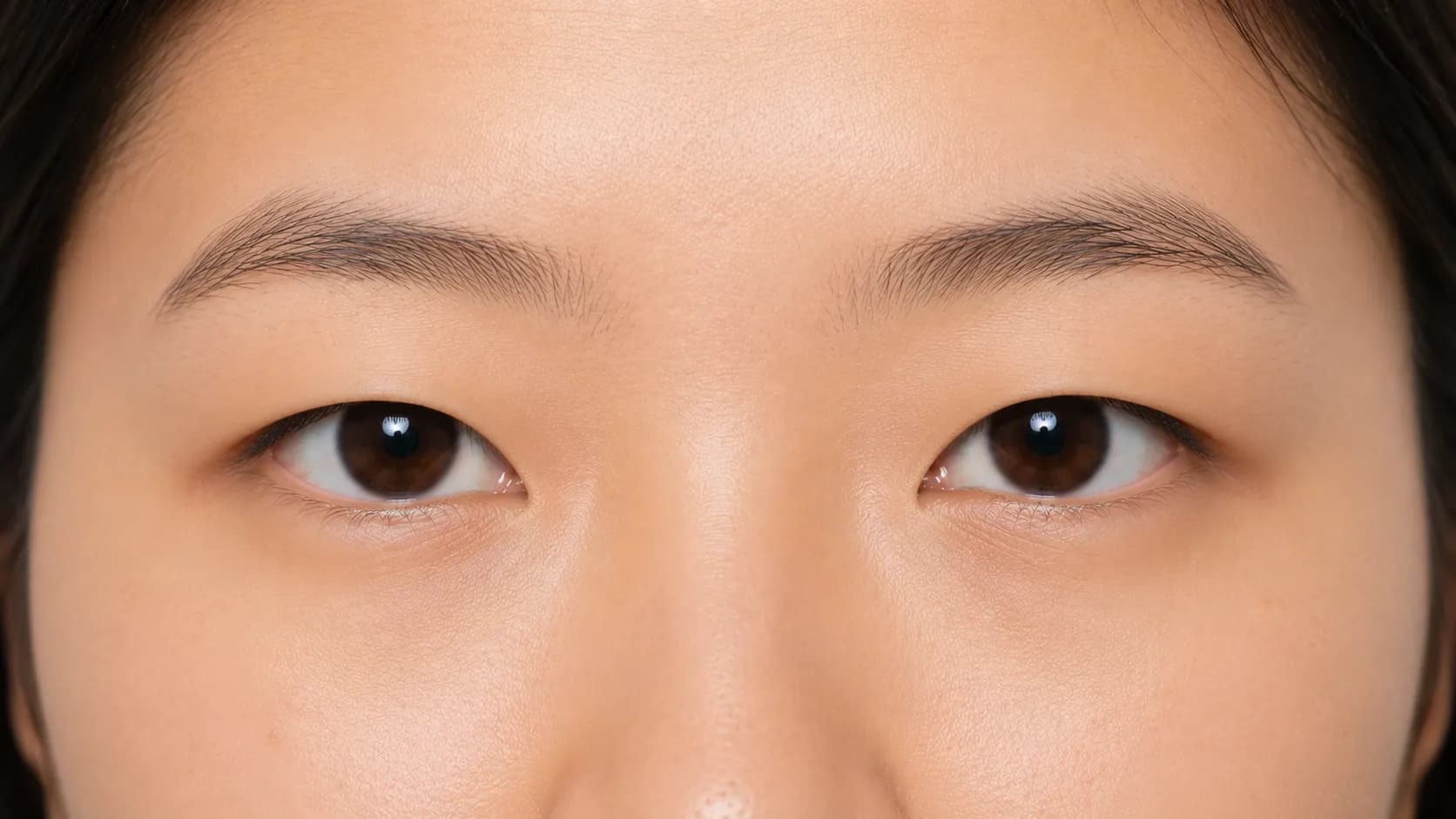 Monolid eyes example showing a single-plane upper lid without a crease