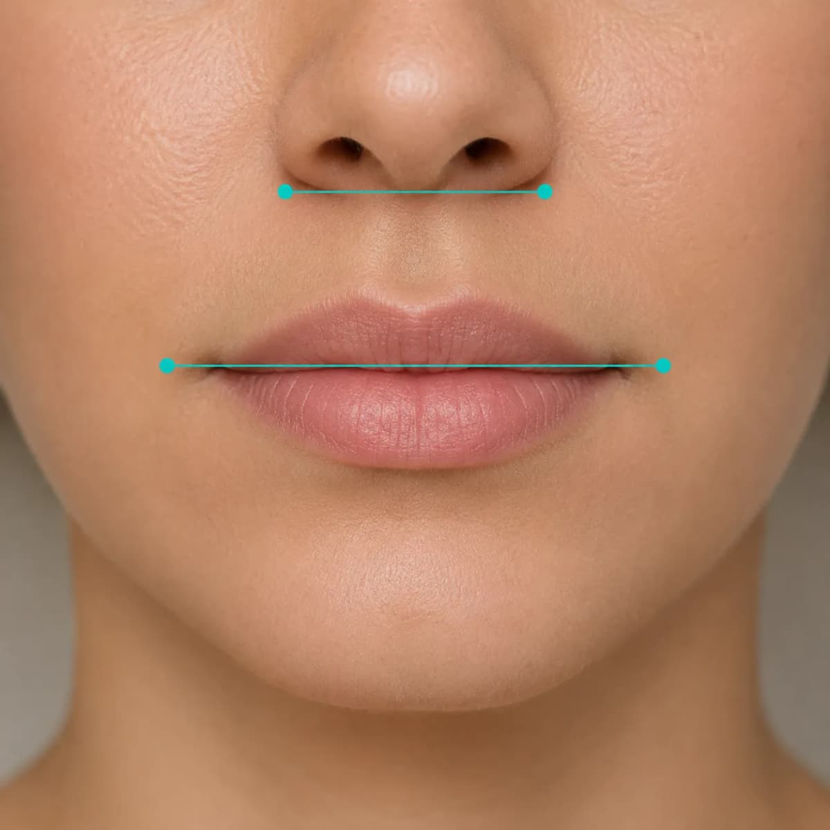 Golden ratio measurement lines comparing mouth width to nose width