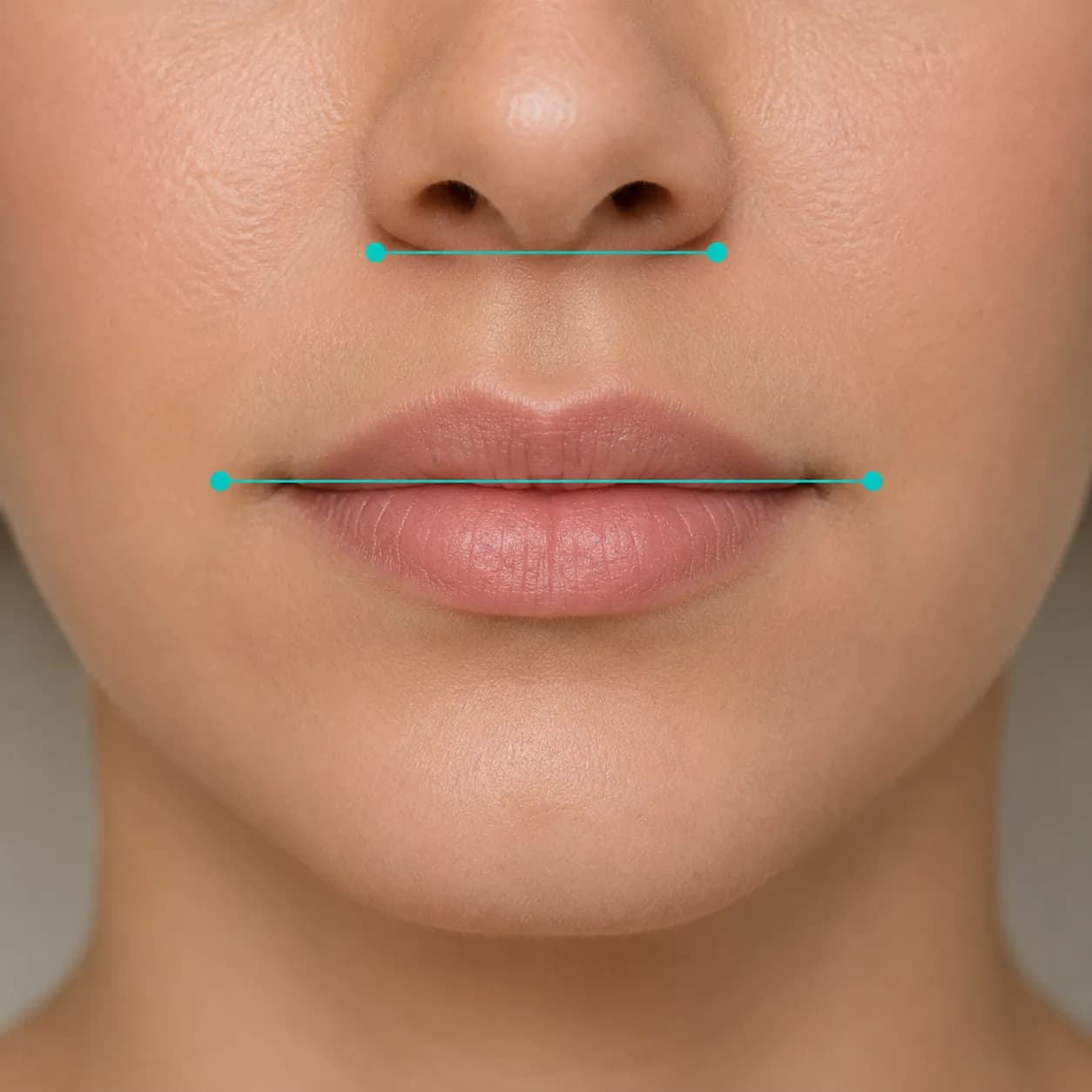 Golden ratio measurement lines comparing mouth width to nose width