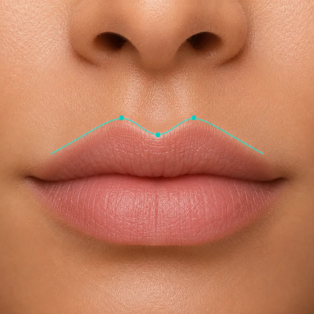 Cupid's bow lip shape diagram with the M-curve traced on the upper lip